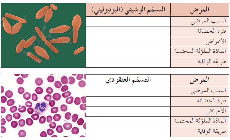 التسمم الوشيقي والتسمم العنقودي